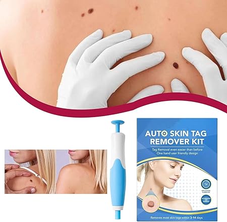 Skin Tag Removal Kit 2-in-1 | Complete Home Care Set with Cleaning Wipes